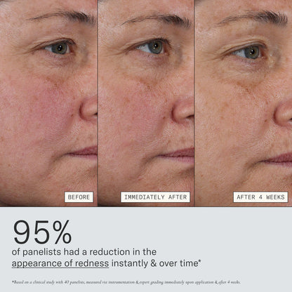 Deliverance 3-in-1 Repair Serum for Redness, Wrinkles, Dark Spots