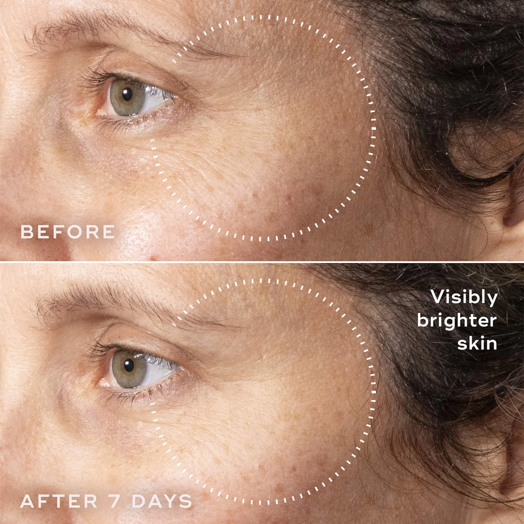 C-Tetra Advanced 20% Stabilized Vitamin C Gel-Serum
