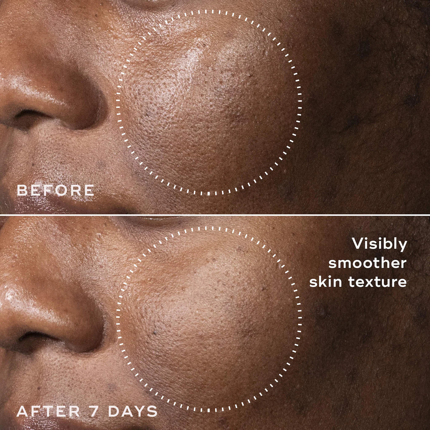 C-Tetra Advanced 20% Stabilized Vitamin C Gel-Serum