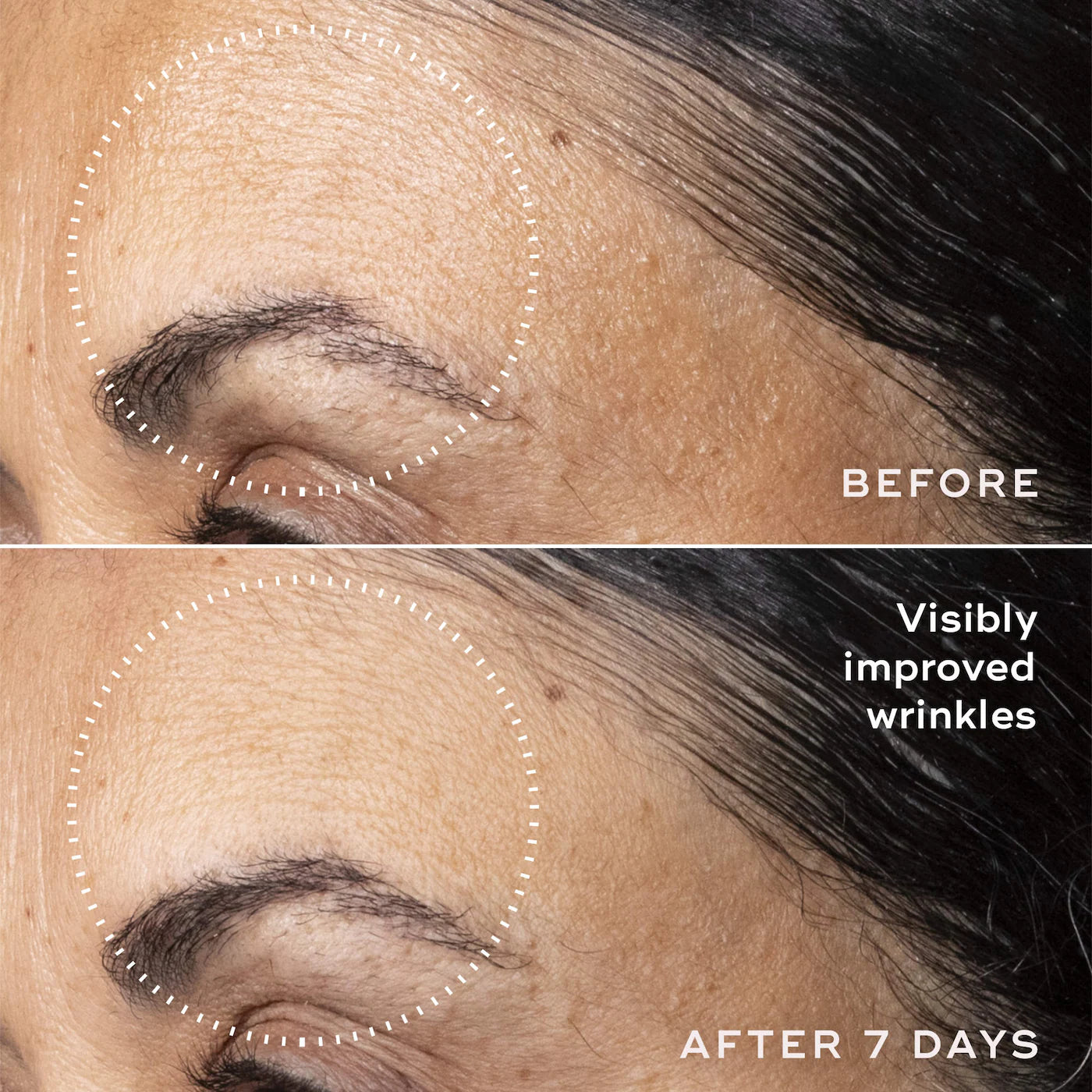 C-Tetra Advanced 20% Stabilized Vitamin C Gel-Serum