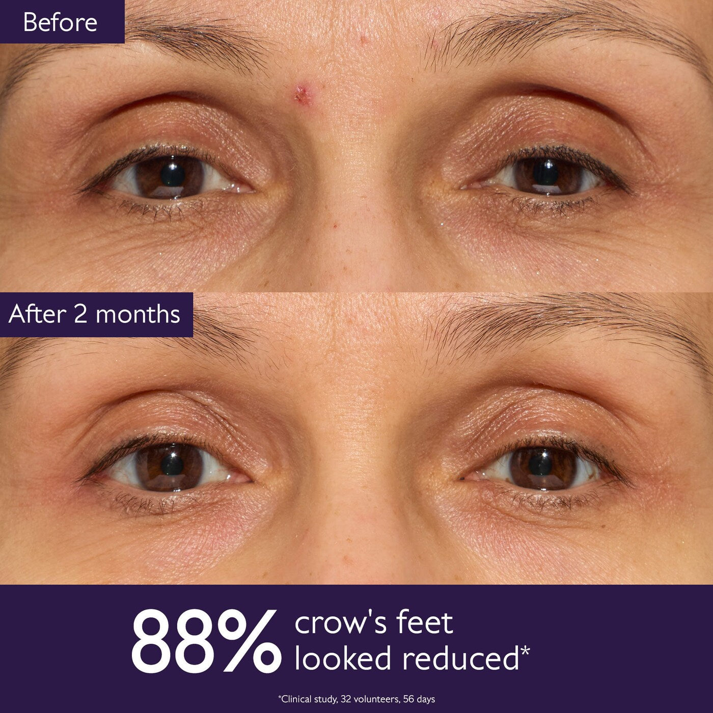 Premier Cru Target All Signs of Aging Gift Set for Fine Lines and Wrinkles