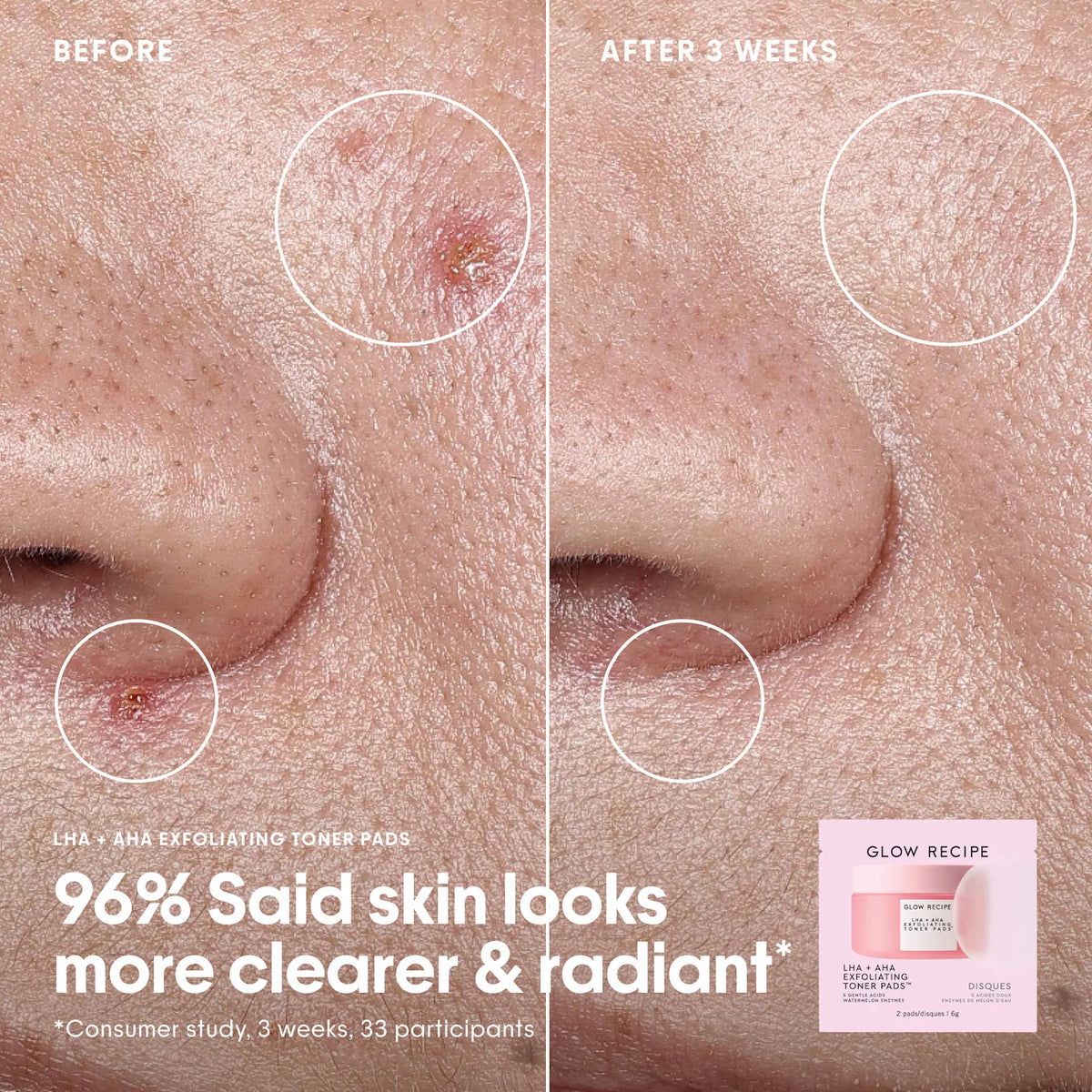 Korean Toner Pad Skin Care Kit for Pores, Dark Spots, and Skin Barrier Repair