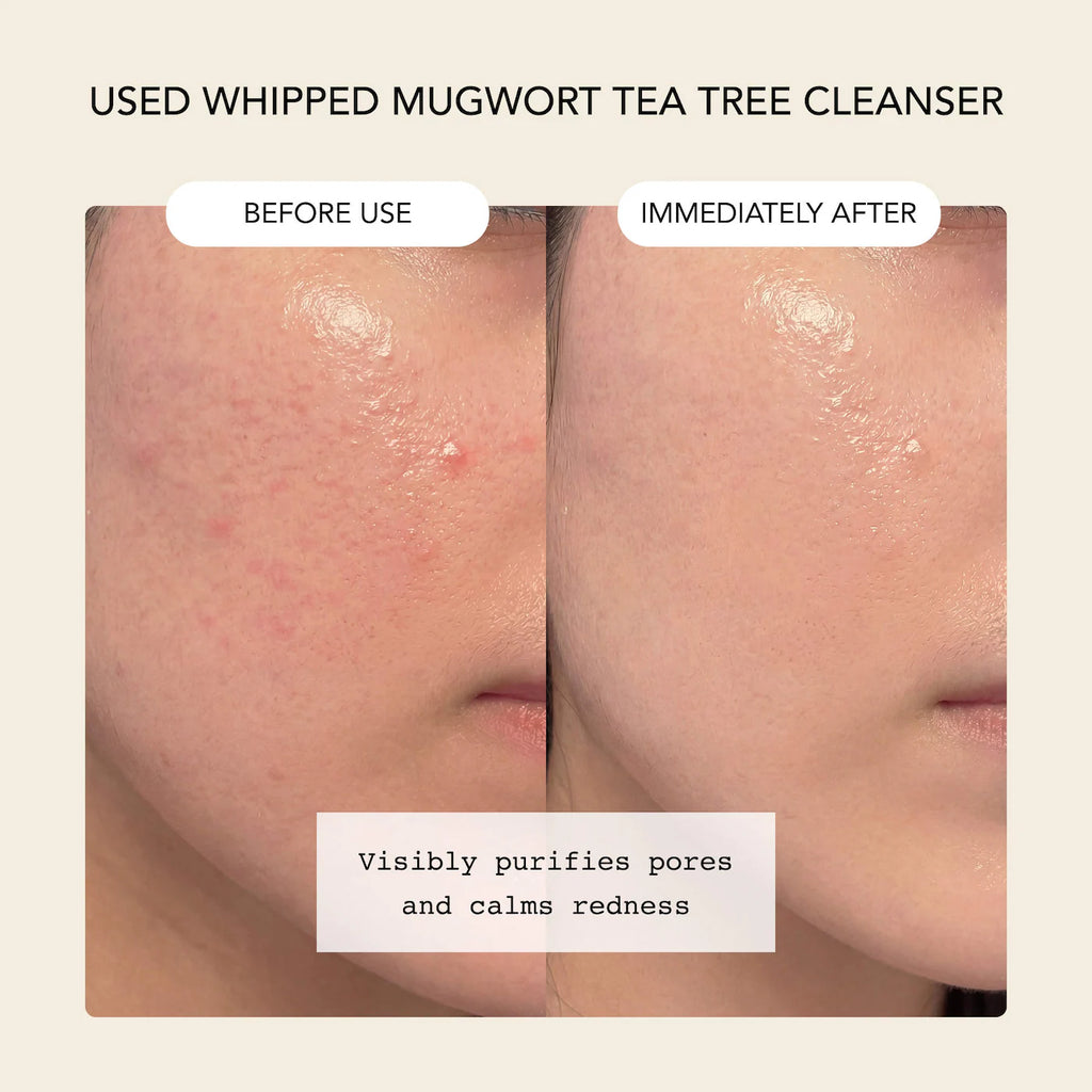 Mugwort Tea Tree Face Mask Cleanser + Madecassoside