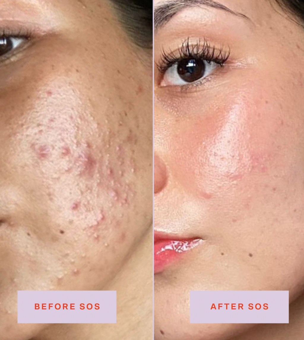 SOS Save.Our.Skin Facial Spray